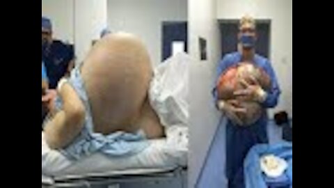 Woman looks like she’s pregnant with 10 children Then she sees scans and can’t believe her eyes