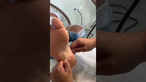 Feet Dead Skin Removal
