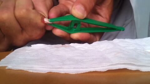 Hand Cyst Sac Extraction | Oddly Satisfying Videos