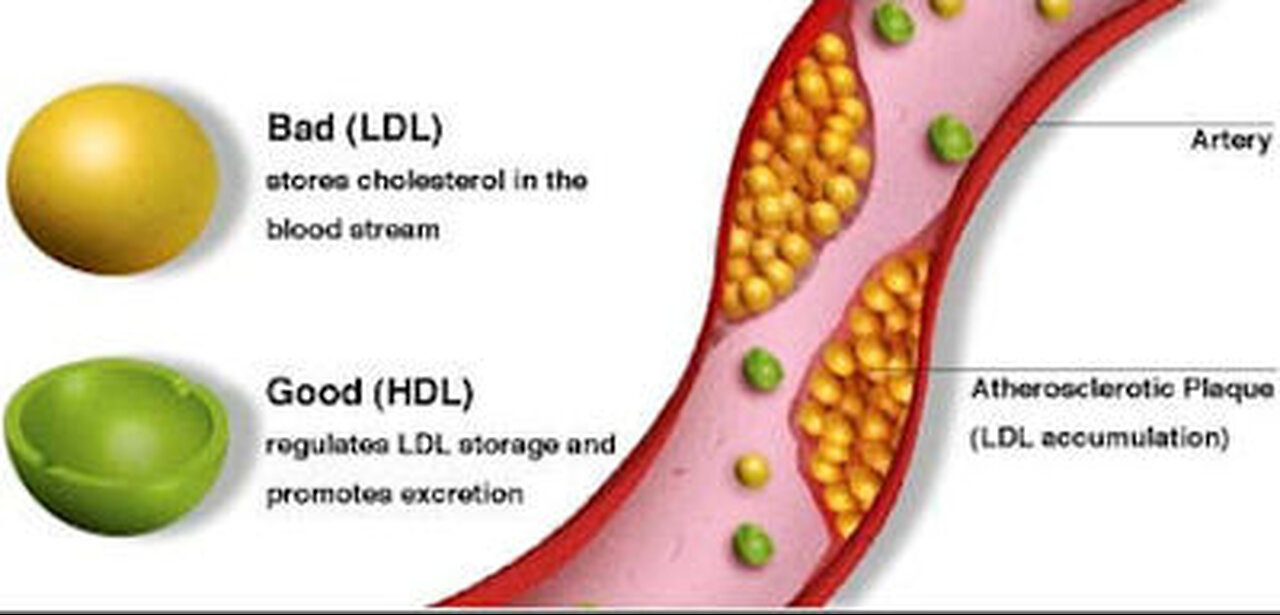 DR. ZEE-The Truth About Cholesterol – LDL Cholesterol & HDL Cholesterol