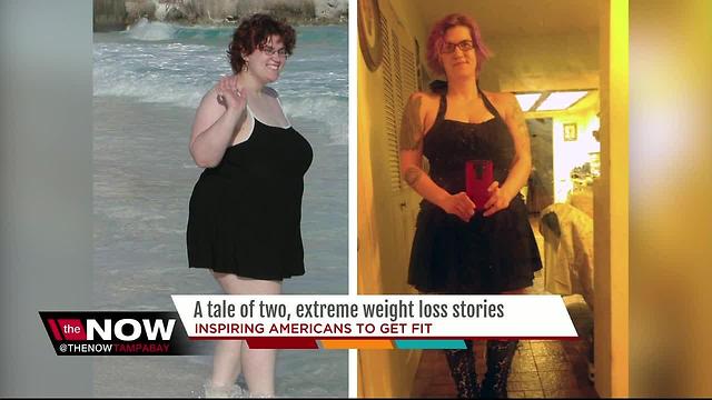 A tale of two, extreme weight loss stories in Tampa Bay