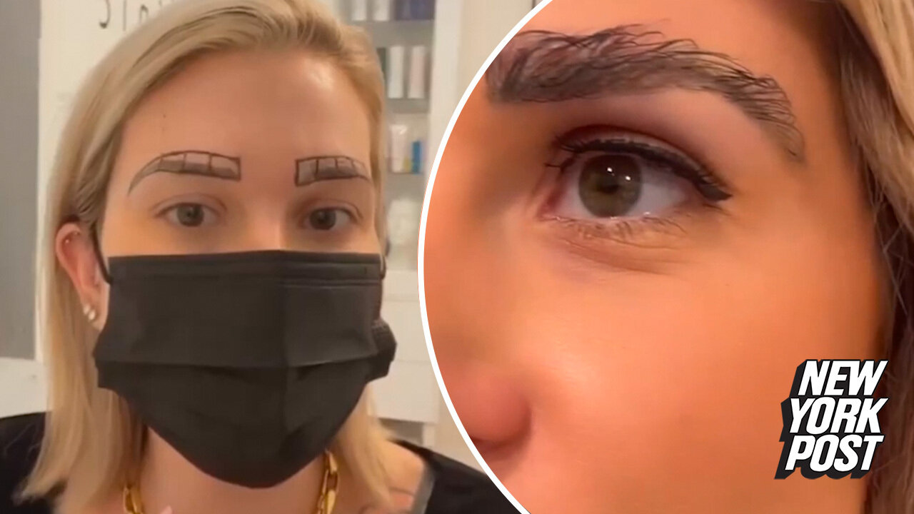 What the 'pluck' Eyebrow transplant before and after