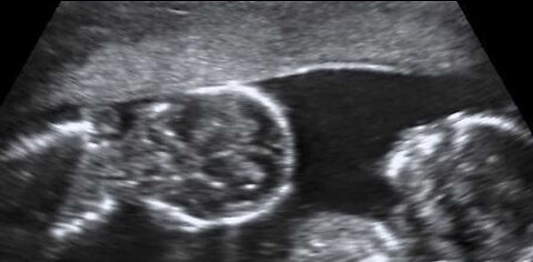 When Does Life Begin?