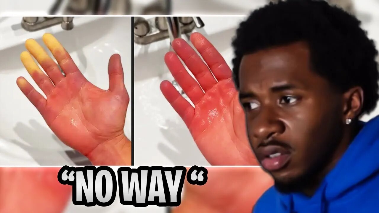 HE HAD TO CUT HIS HAND OFF !!? Every Barber's Worst Nightmare (REACTION )