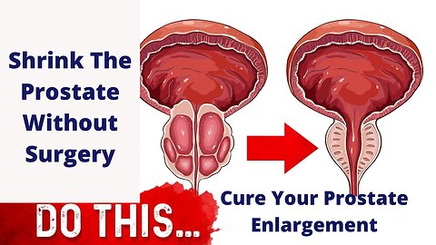 How To Cure Prostate Enlargement