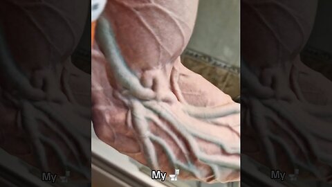"Bro Destroyed His Arm..." 🤦‍♂️
