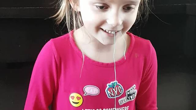 Brave Little Girl Pulls A Loose Tooth With Remote-Controlled Truck