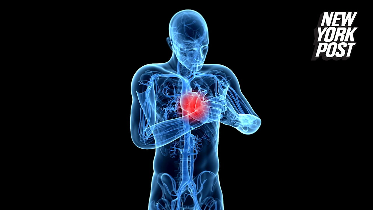 Deadly heart attacks are more common on 'Blue Monday'