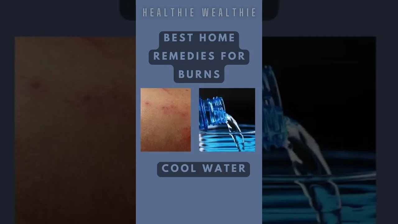 Best Home Remedies for Burns || #health || #shorts || #healthy