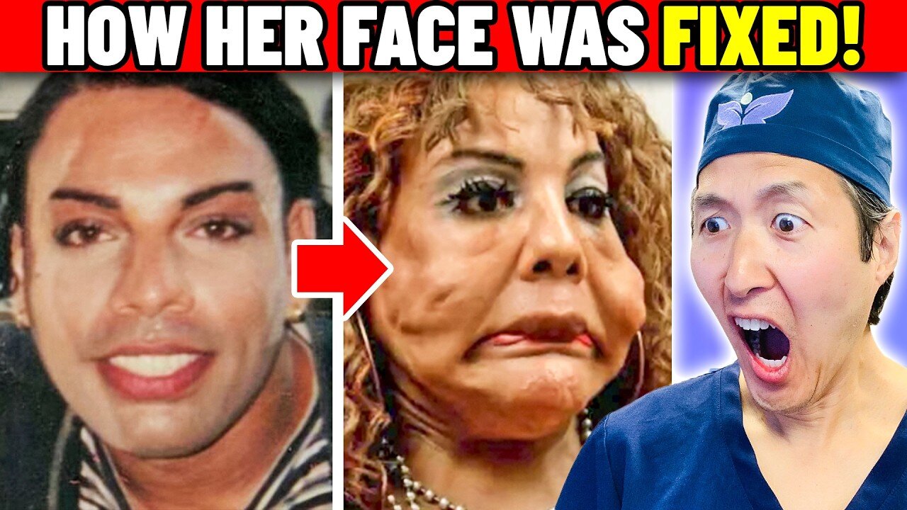 Her Face is Filled with Cement and Fix-a-Flat! EXTREME Bodies Explained!