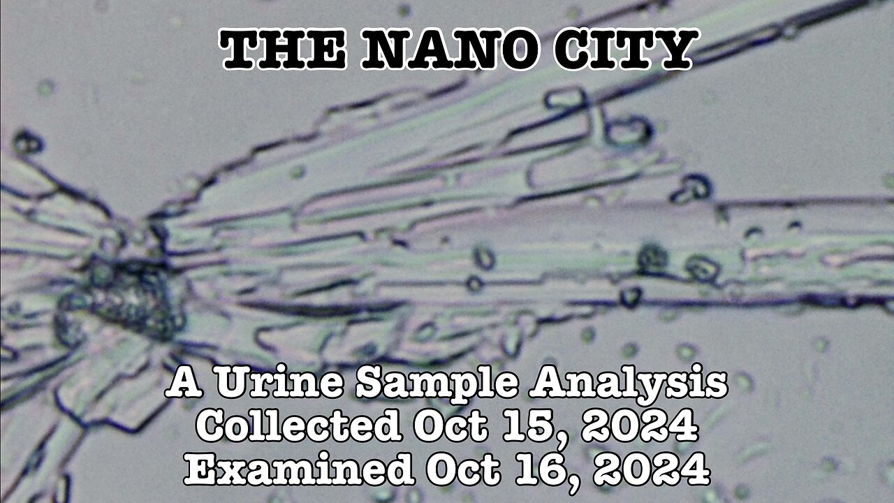 The Nano City - Urine Sample Exam (Oct 16, 2024)