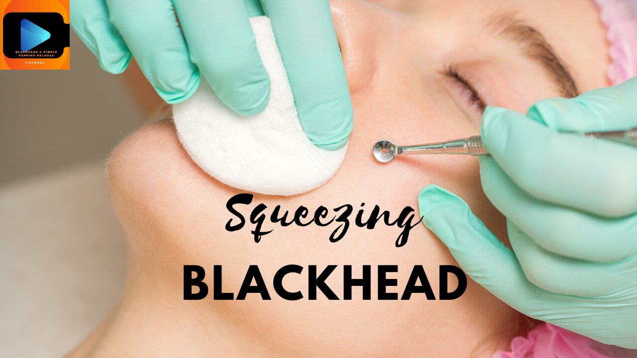 Squeezing Blackheads