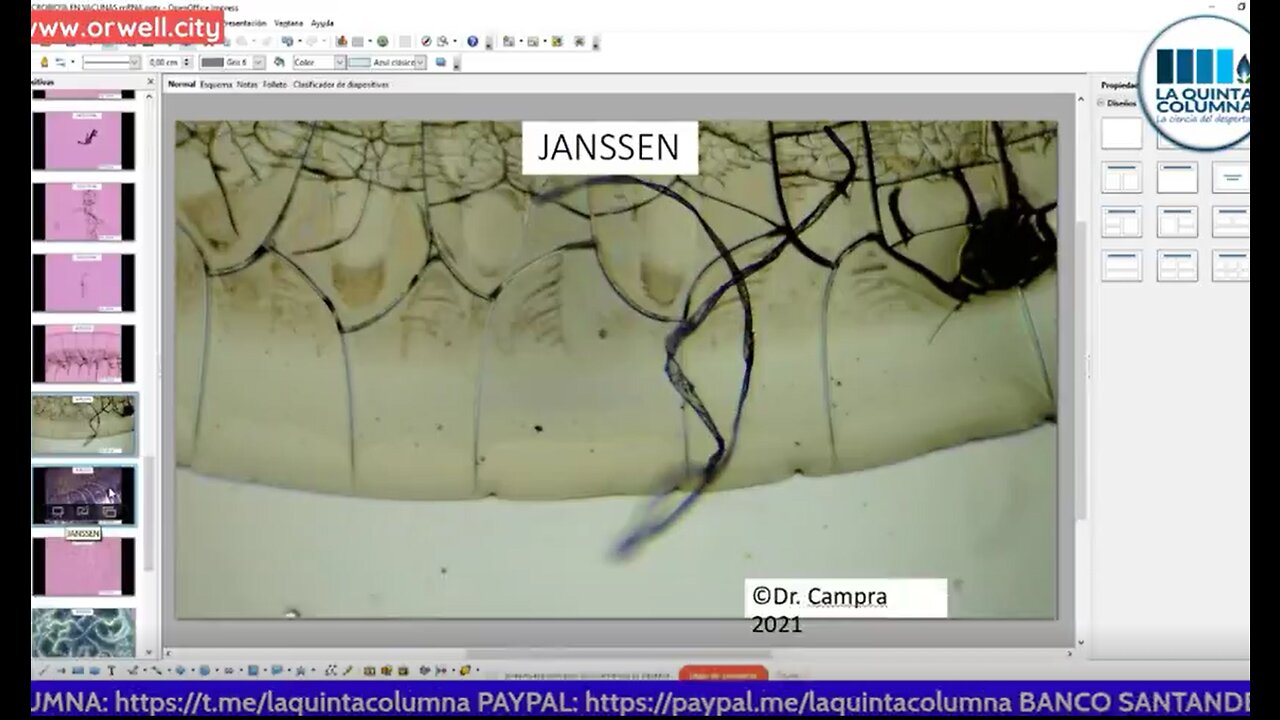 Possible MICROBIOTA in COVID mRNA Vaccines (Dr. Pablo Campra Quinta Columna) - 10-16-21