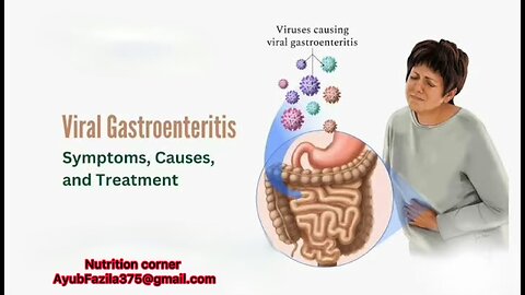 What is viral gastroenteritis ? Causes, symptoms and treatment of viral gastroenteritis.