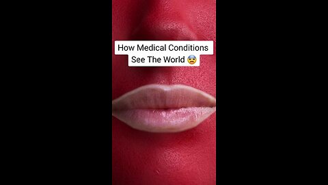 How Medical Conditions See The World