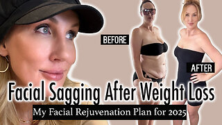 Weight Loss & Facial Sagging - My 2025 Facial Rejuvenation Plan