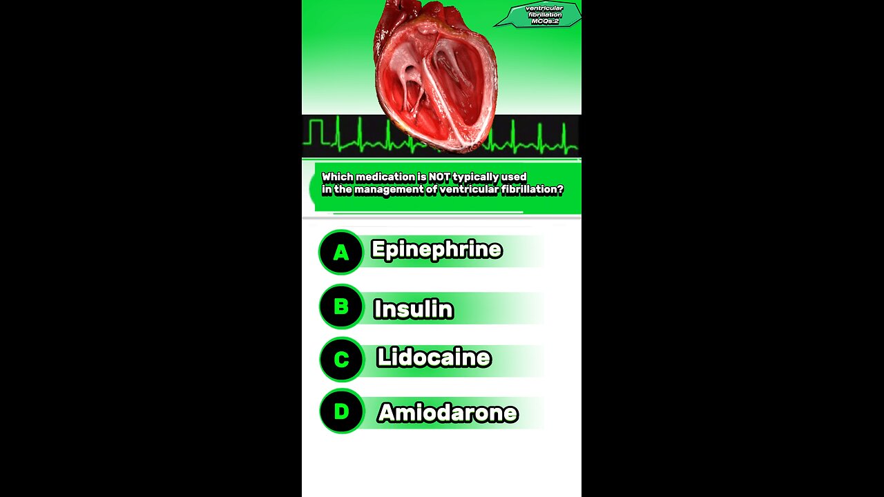 ventricular fibrillation ,cardiac arrhythmia #heart: microbiology laboratory test videos