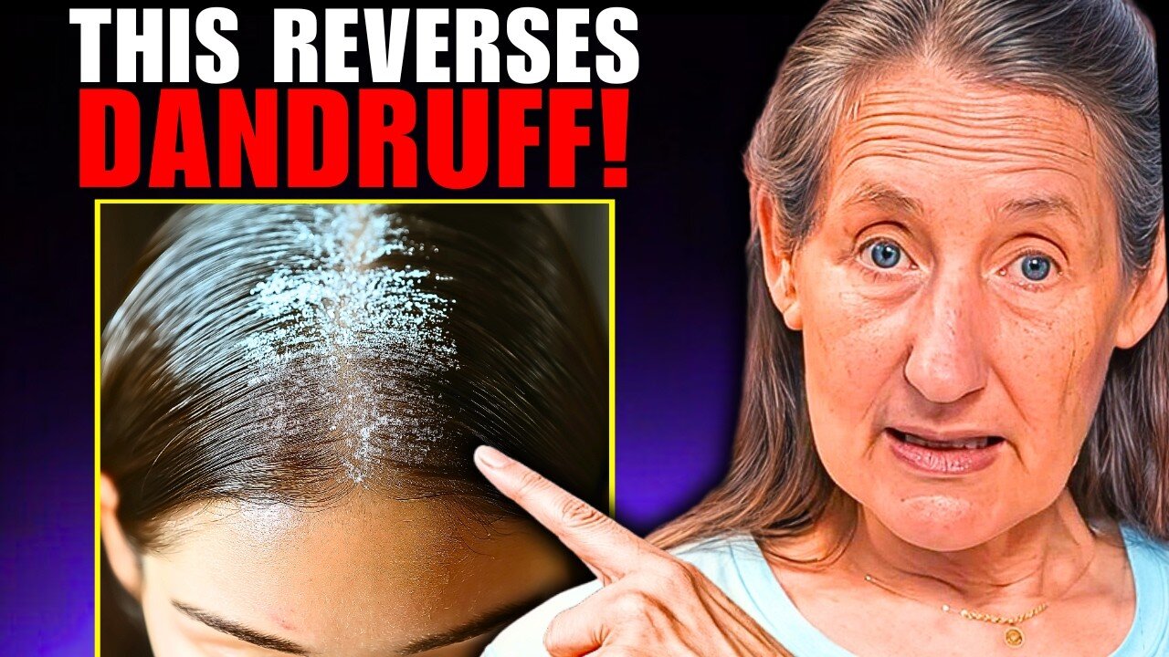 Barbara O'Neill| The REAL Cause and Treatment for DANDRUFF & HAIR LOSS!