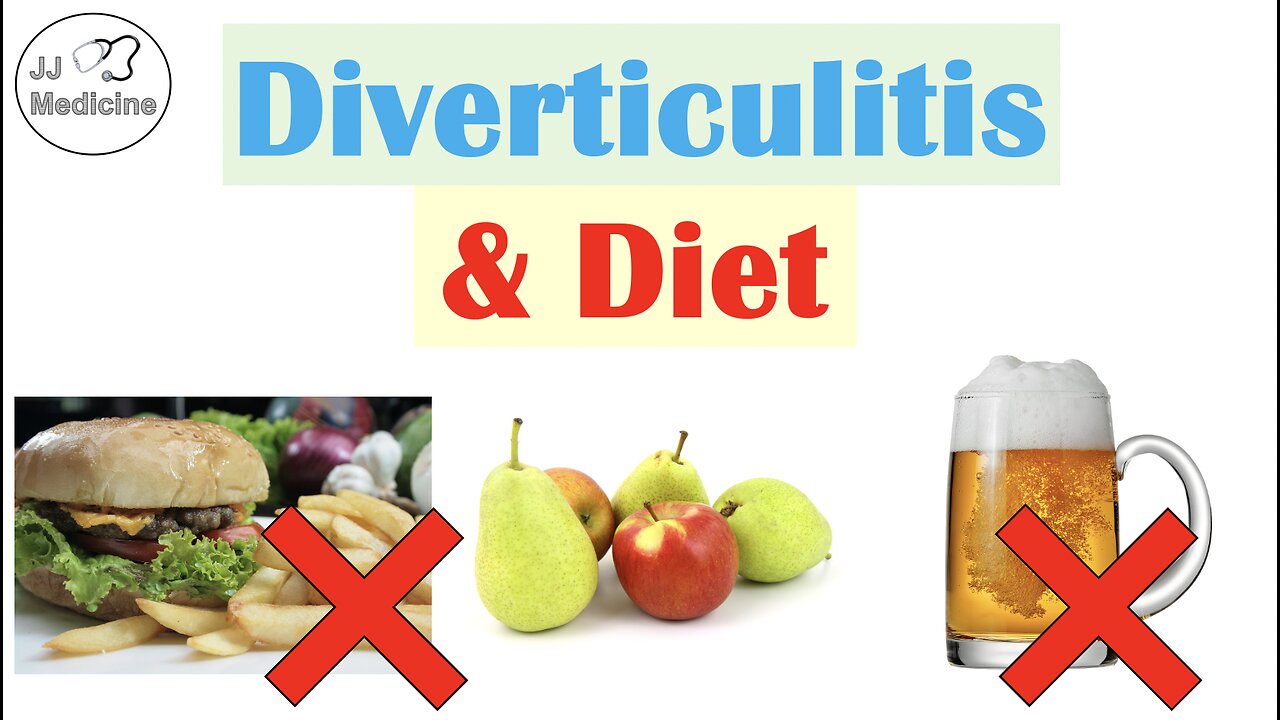 Diverticulitis & Diet | Foods & Beverages That Increase and Decrease Risk