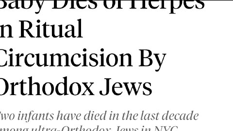 Oral Suction Circumcisions (WTF)