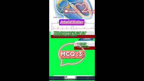 Arterial flutter #flutter -#arterialflutter #arrthythmia #CardiacArrhythmia #Cardiology 3D Medico