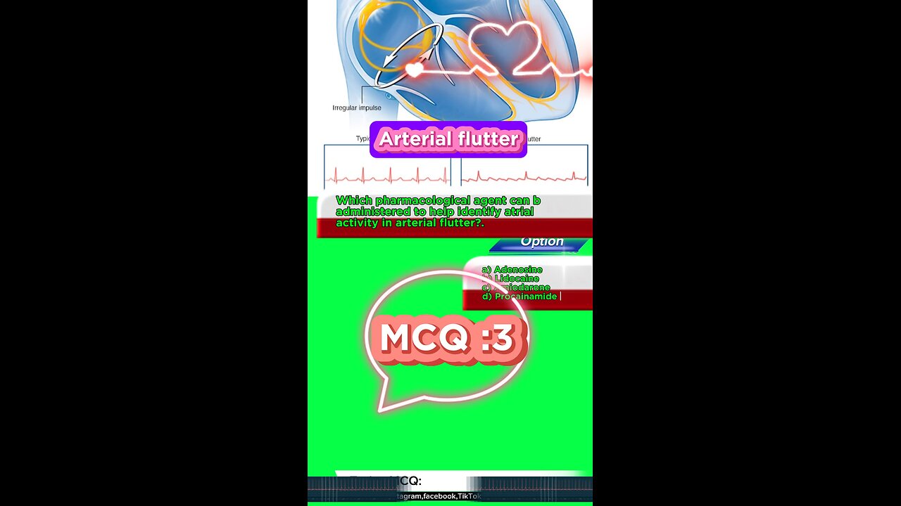 Arterial flutter #flutter -#arterialflutter #arrthythmia #CardiacArrhythmia #Cardiology 3D Medico