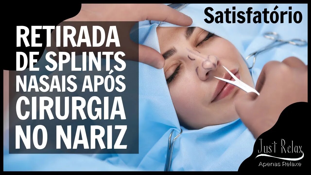Retirada do Splint Nasal Cateter Aerador Satisfatório #2 - Just Relax | Apenas Relaxe