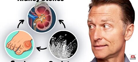 The Connection between Oxalates, Gout, and Kidney Stones