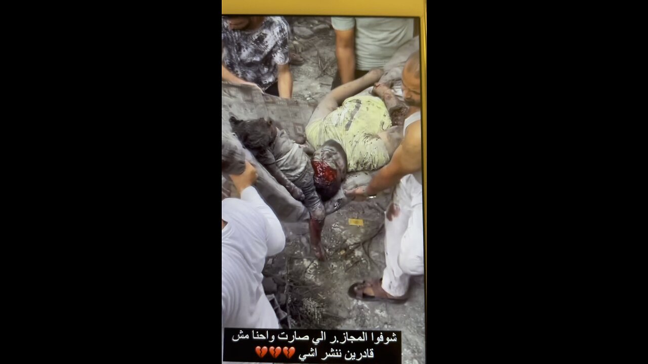 WHAT THE WESTERN MEDIA WONT SHOW YOU IN GAZA
