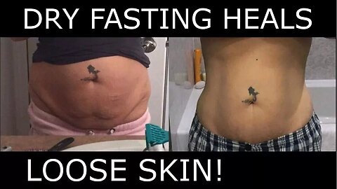 DRY FASTING HEALS LOOSE SKIN!