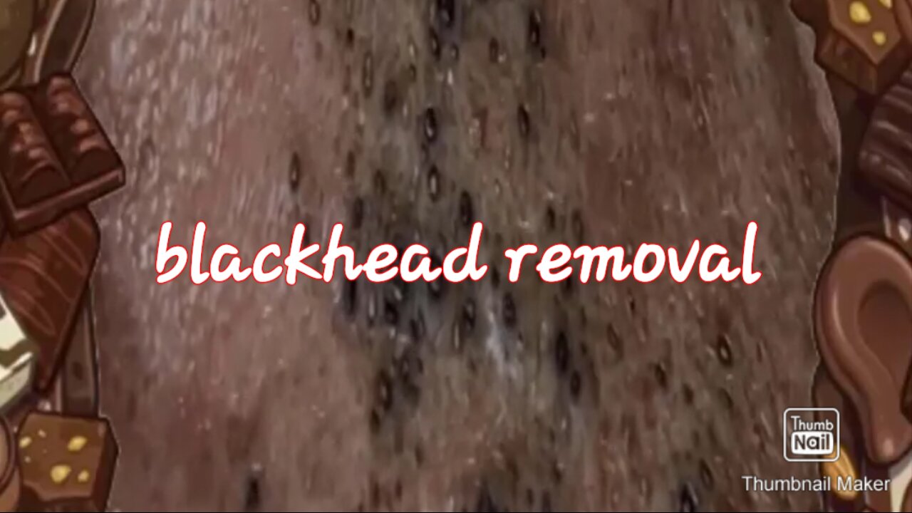 Blackhead removal satisfying video #1