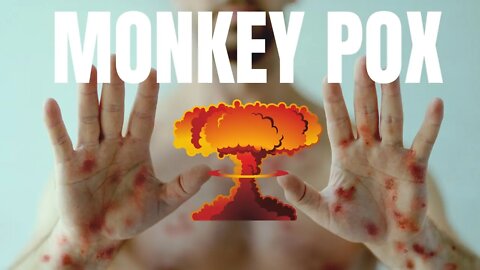 Is Monkeypox Setting Up More Medical Tyranny?