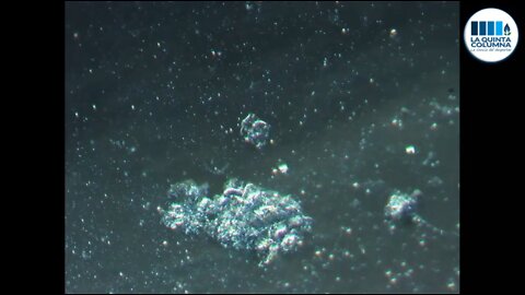 La Quinta Columna - Programa 217 - MÁS MICROSCOPIAS INÉDITAS DE LA "VACUNA" PFIZER BIONTECH