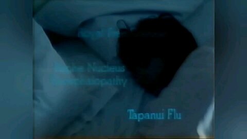 "Disbelief" in Myalgic Encephalomyelitis (M.E.) and a variation of other names; connected