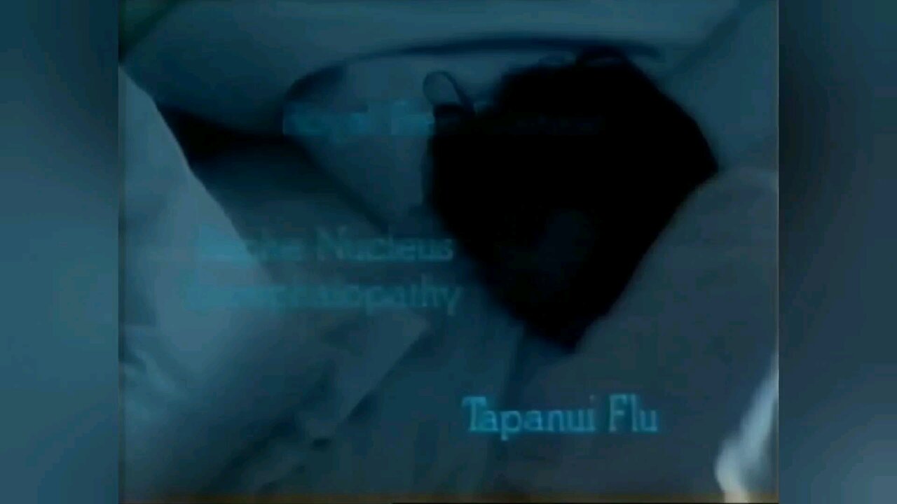 "Disbelief" in Myalgic Encephalomyelitis (M.E.) and a variation of other names; connected