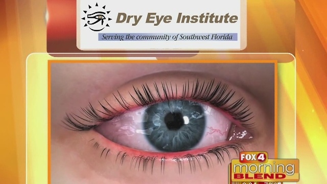 Dry Eye Institute: LipFlow 12/7/16