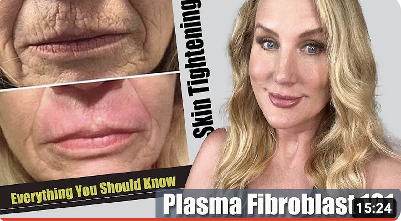 Plasma Fibroblast // Everything You Need to Know