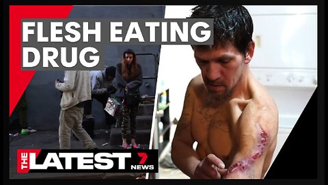 The flesh-eating drug taking over America - 7NEWS