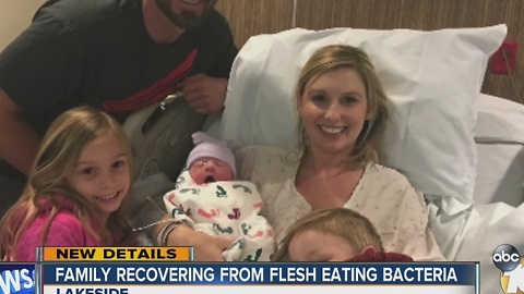 UPDATE: Family recovering from flesh-eating bacteria