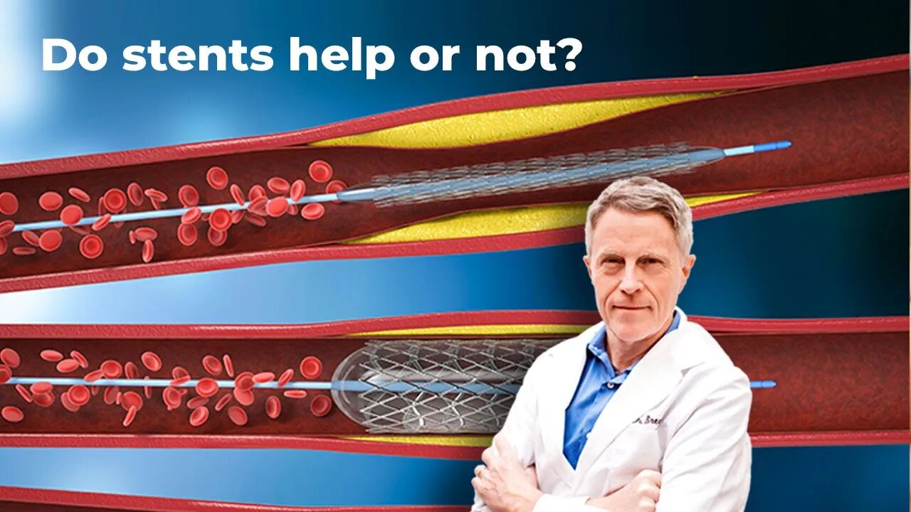 Do stents help or not?