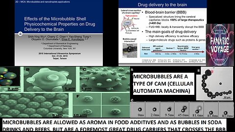 Microbubble Shell Physicochemical Properties on Ultrasound-Mediated Drug Delivery to the Brain