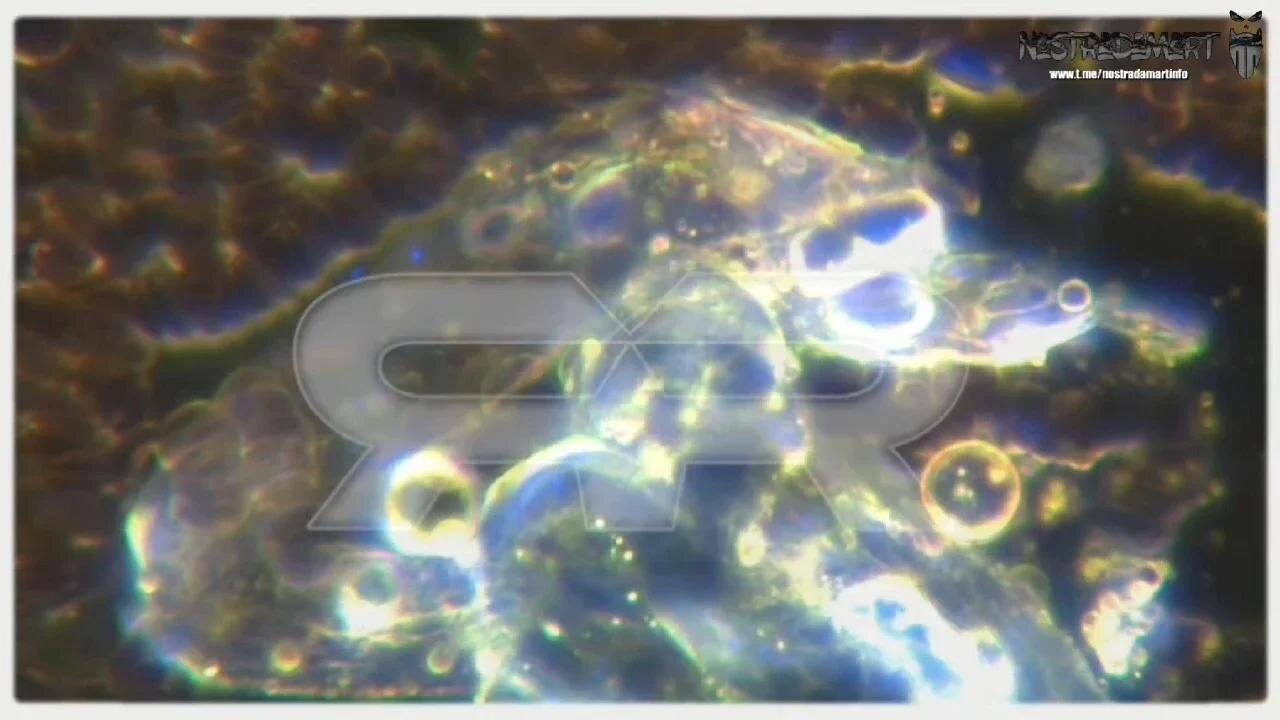 Reese Report (FR) - Nanobots auto-réplicatifs trouvés dans les vaccinés et les non vaccinés