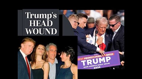 Antichrist 45: Pedophile Psyop Donald Trump Suffers Head Wound!