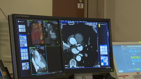 Fond du Lac hospital utilizing advanced cardiac scanning