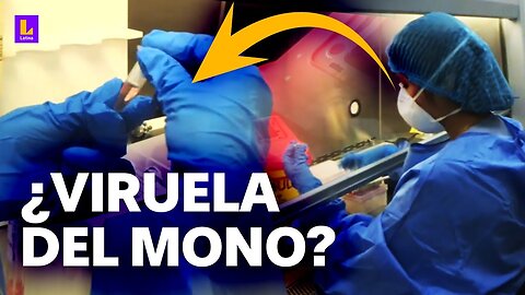 ¿Cómo se detecta la viruela del mono? EsSalud muestra laboratorio donde se procesan pruebas