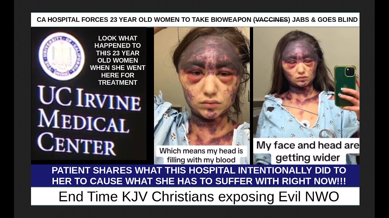 CA HOSPITAL FORCES 23 YEAR OLD WOMEN TO TAKE BIOWEAPON JABS & GOES BLIND