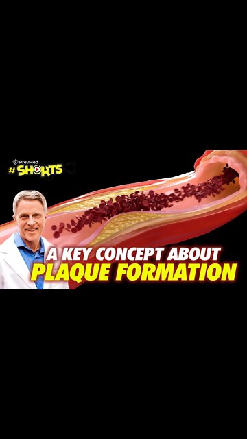 #SHORTS A key concept about plaque formation