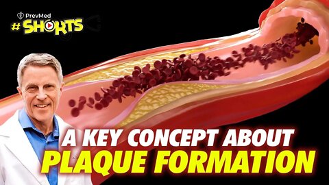 #SHORTS A key concept about plaque formation