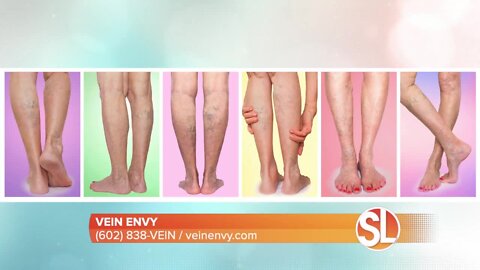 Vein Envy offers a minimally invasive techniques to treat vein disease