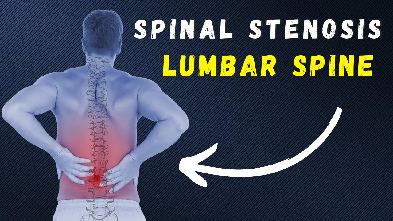 Spinal Stenosis daily exercises for pain relief